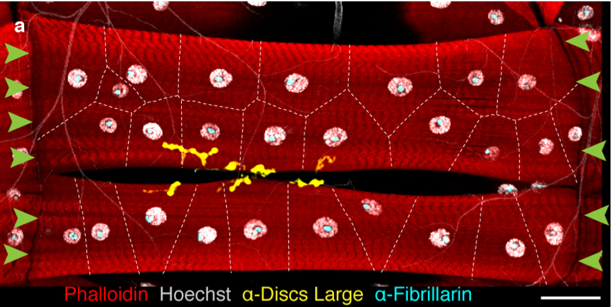 Image of Drosophila larval muscle cells, VL3 and VL4