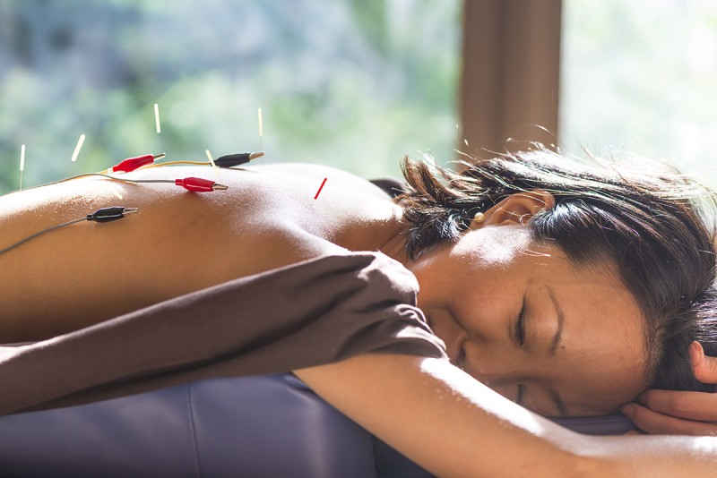 Patients say electro-acupuncture feels like a gentle tapping of the skin, according to Dr. Mao.