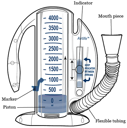 الشكل 1. مقياس التنفس المحفّز