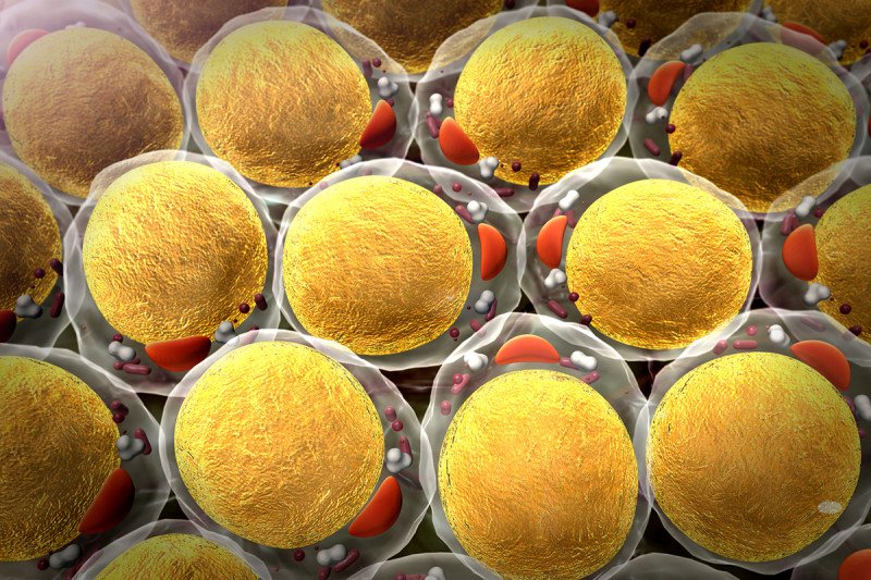 Large cells filled with yellow-colored fat